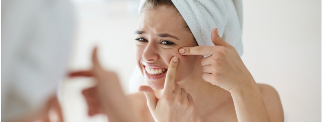 Imam mozolje - kaj lahko storim?