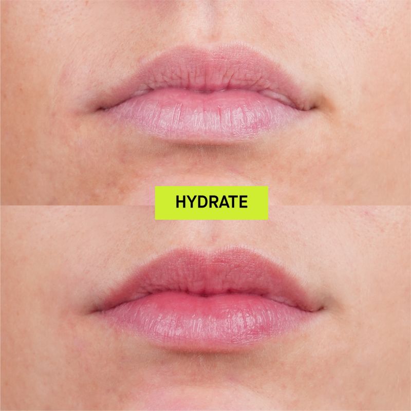 Hydrate (Hyaluronic Acid Lip Treatment)