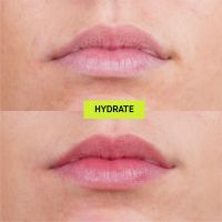 Hydrate (Hyaluronic Acid Lip Treatment)